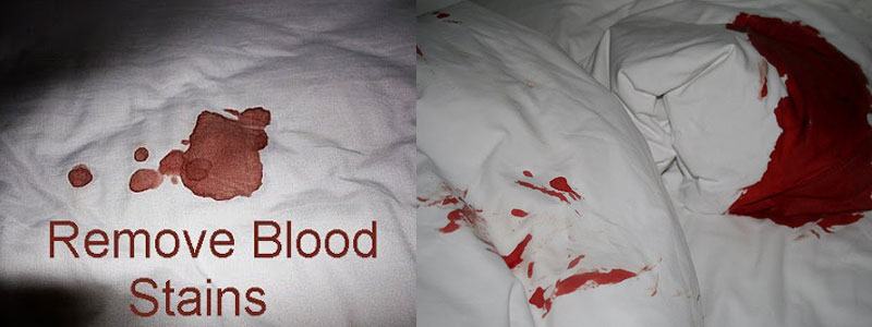 Blood Stain Removal From Mattress